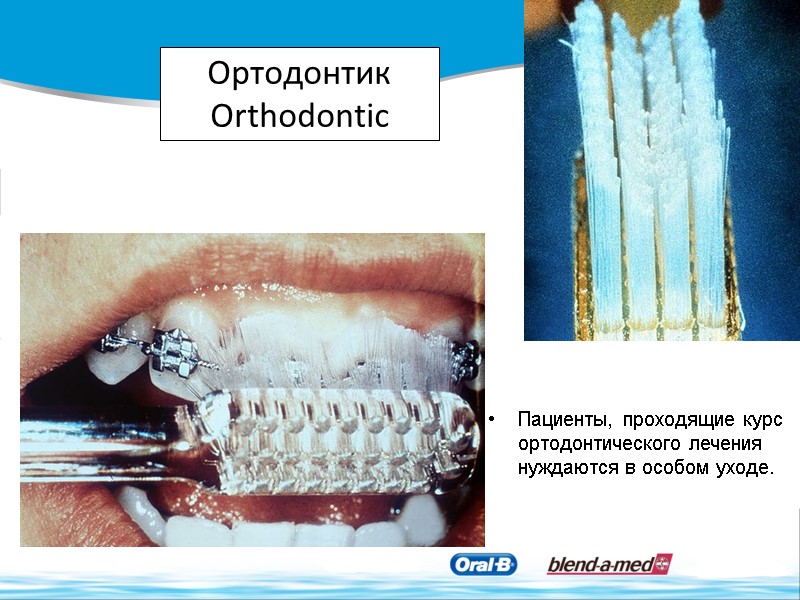 Ортодонтик Orthodontic Пациенты, проходящие курс ортодонтического лечения нуждаются в особом уходе.